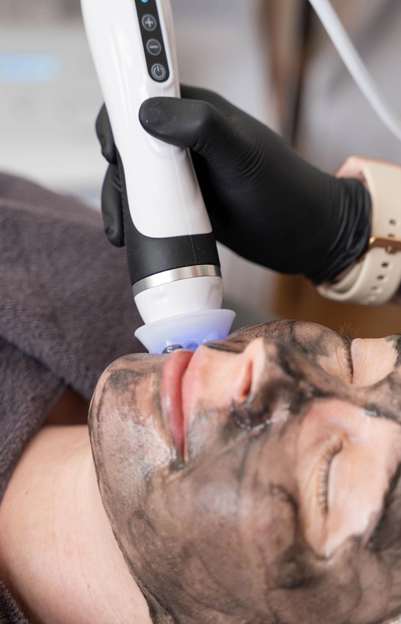 Hautbehandlung bei einer Kundin